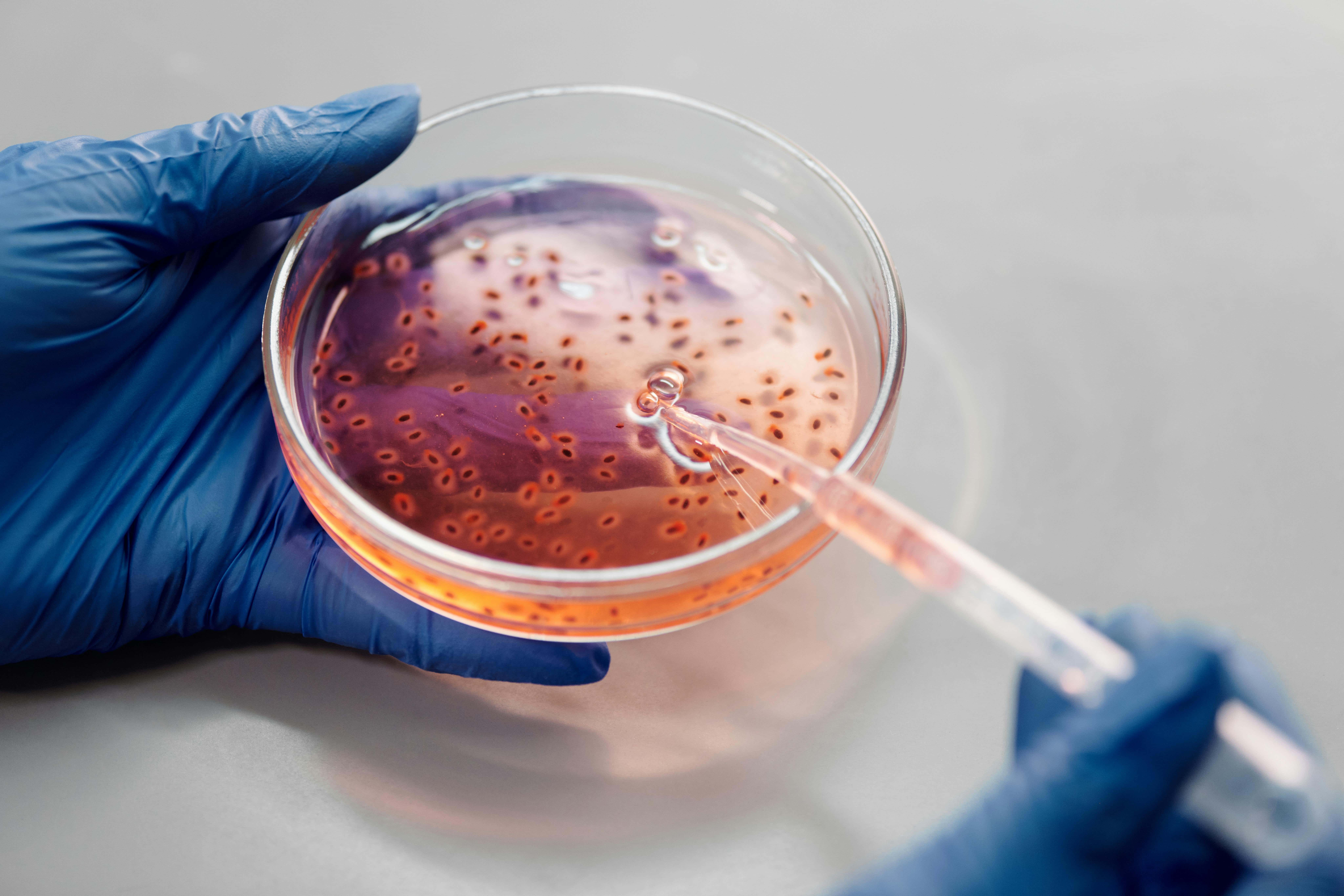 Устойчивость планктонной и биопленочной форм кишечной палочки E.coli к растворимым нитрофуранам